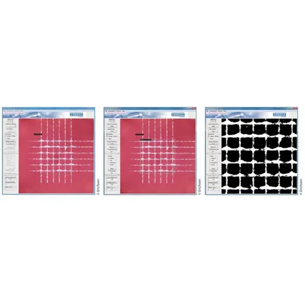 Auswertesoftware zur Gitterschnittprüfung – CrossScan 295